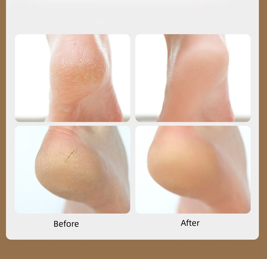 Fasola Heel Cushion Pads Heel Grips/Heel Liners Heel Protectors for Cracked Heels White 10*8cm 1 Pair X2Pack
