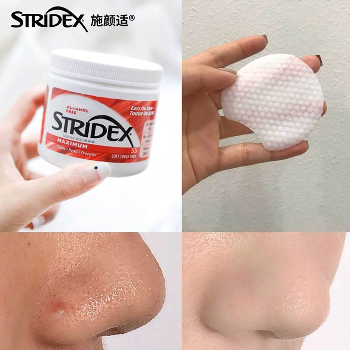 Stridex-2%-Salicylic-Acid-Acne-Control-Pads-Maximum-Strength-55-Pcs-X2Pack-1