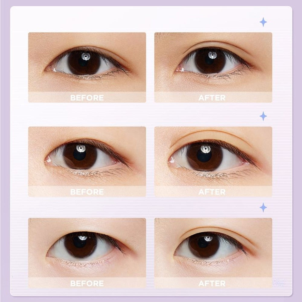 Everbab S Size Natural Invisible Double Eyelid Tape Sticker Suitable for Short Narrow Eye Shape 400pcs X4pack